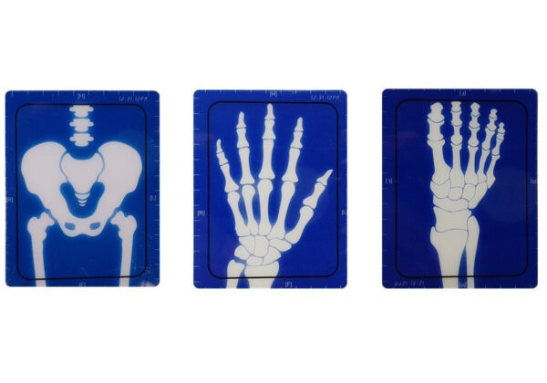 Medical Kit Apparatus Medical Accessories X-ray Doctor - Image 5